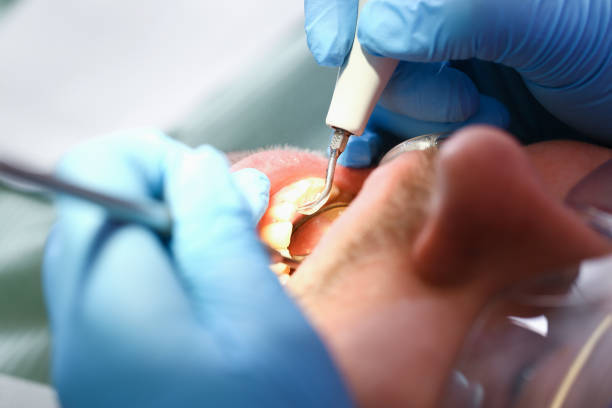 Best Weekend Emergency Dentist in Tyndall, SD