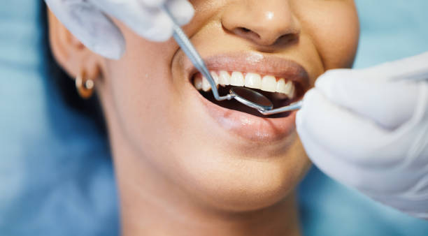 Best Same-Day Emergency Dental Services in Tyndall, SD